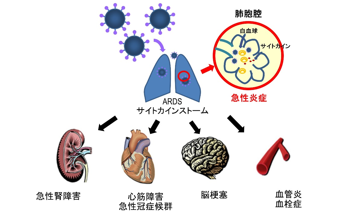 白血球 コロナ 最新免疫学から分かってきた新型コロナウイルスの正体―宮坂昌之・大阪大学名誉教授